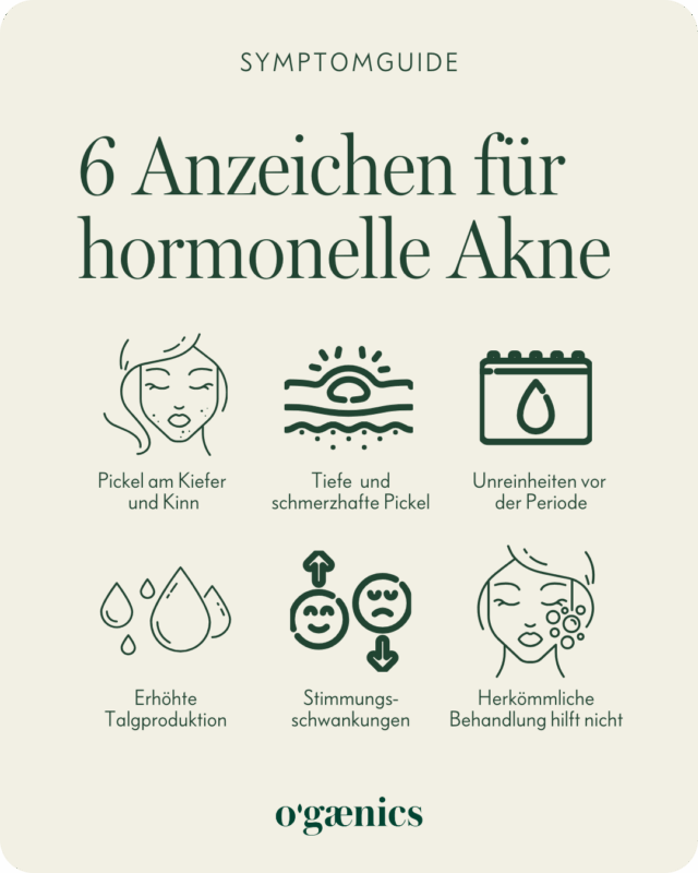 Infografik 6 Zeichen Hormonelle Akne